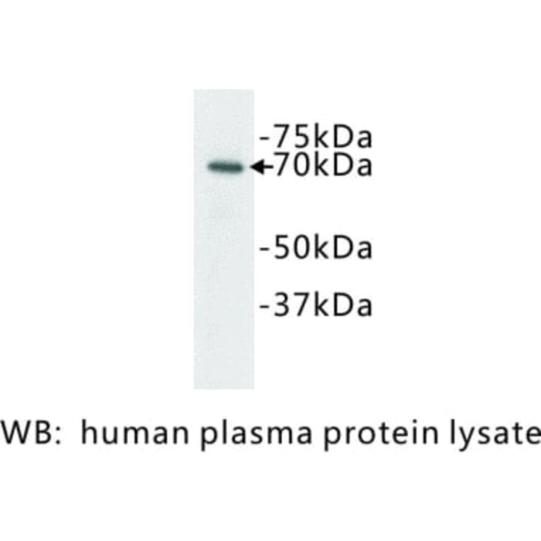 Western Blot - Anti-Complement C3 Antibody (BPA1038) - Antibodies.com