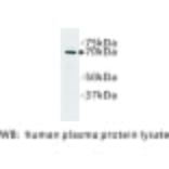Western Blot - Anti-Complement C3 Antibody (BPA1038) - Antibodies.com