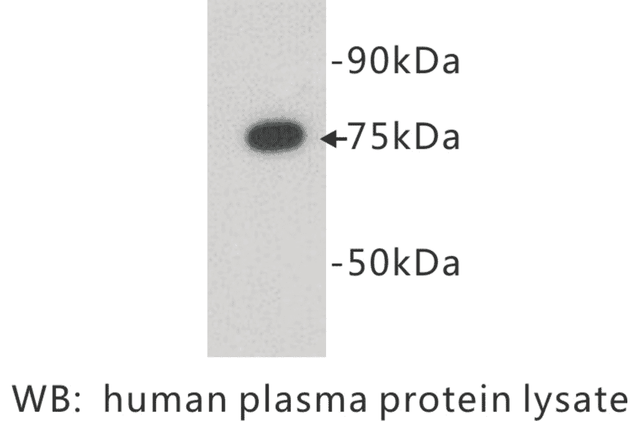 Western Blot - Anti-Complement C4 Antibody (BPA1039) - Antibodies.com