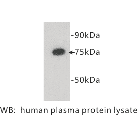 Western Blot - Anti-Complement C4 Antibody (BPA1039) - Antibodies.com