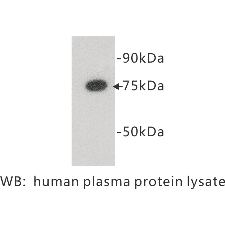 Western Blot - Anti-Complement C4 Antibody (BPA1039) - Antibodies.com