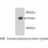 Western Blot - Anti-Complement C4 Antibody (BPA1039) - Antibodies.com