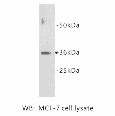 Western Blot - Anti-Cyclin D1 Antibody (BPA1041) - Antibodies.com