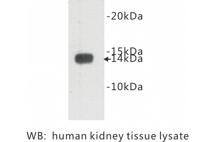 Western Blot - Anti-Cystatin C Antibody (BPA1042) - Antibodies.com
