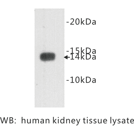 Western Blot - Anti-Cystatin C Antibody (BPA1042) - Antibodies.com