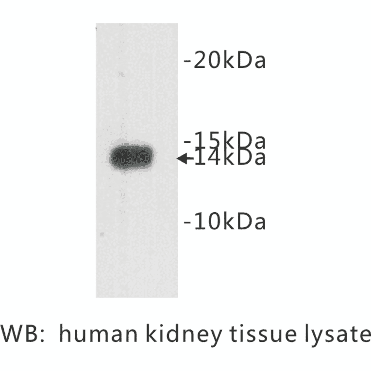 Western Blot - Anti-Cystatin C Antibody (BPA1042) - Antibodies.com
