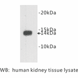 Western Blot - Anti-Cystatin C Antibody (BPA1042) - Antibodies.com