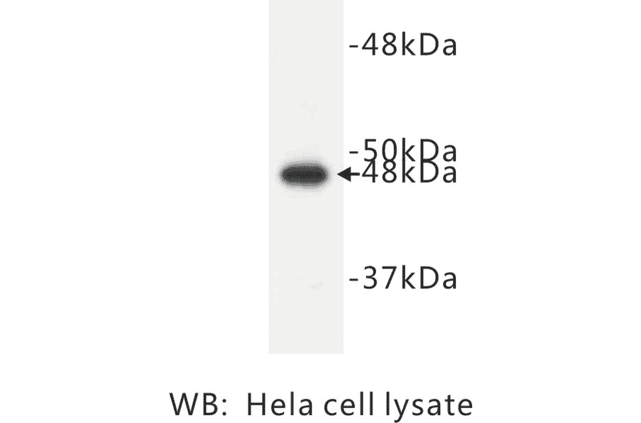 Western Blot - Anti-Cytokeratin 17 Antibody (BPA1043) - Antibodies.com