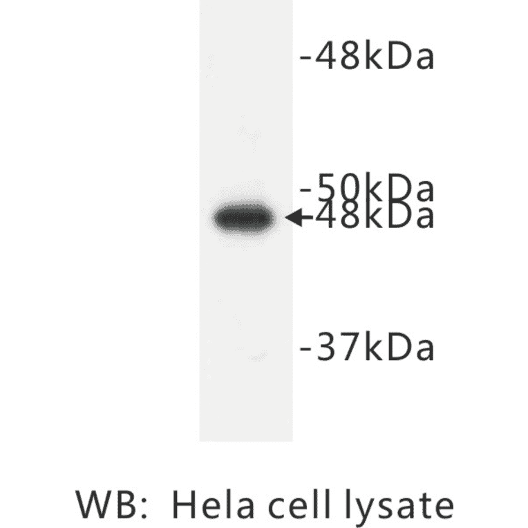 Western Blot - Anti-Cytokeratin 17 Antibody (BPA1043) - Antibodies.com