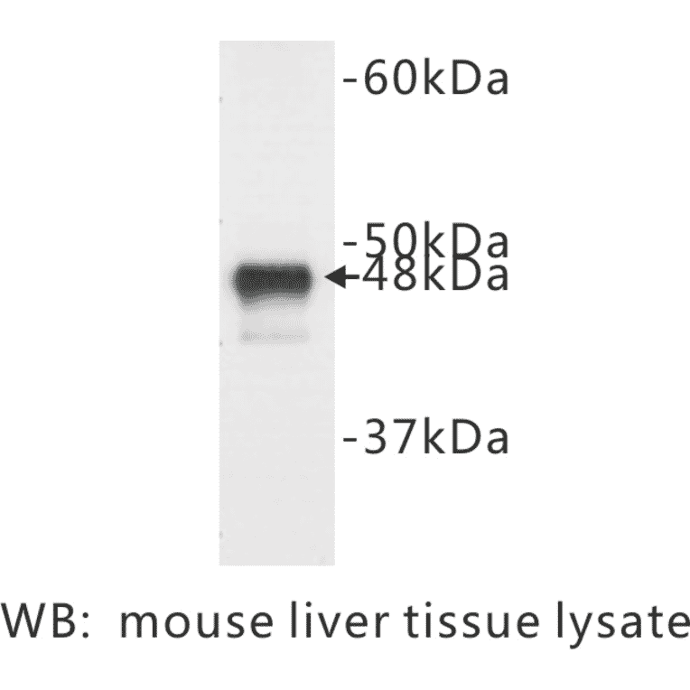 Western Blot - Anti-Cytokeratin 18 Antibody (BPA1044) - Antibodies.com