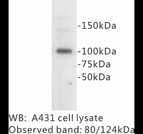 Western Blot - Anti-E Cadherin Antibody (BPA1048) - Antibodies.com
