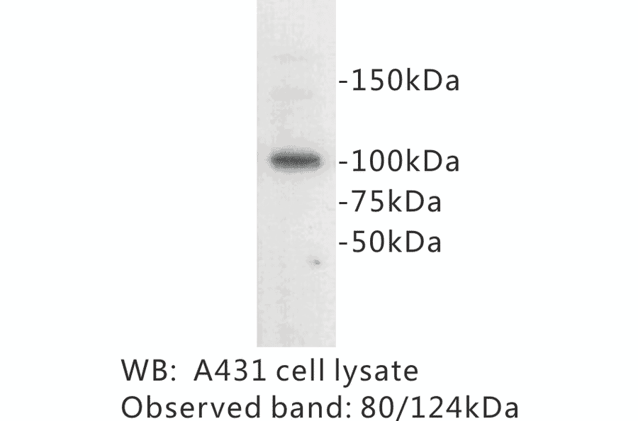 Western Blot - Anti-E Cadherin Antibody (BPA1048) - Antibodies.com