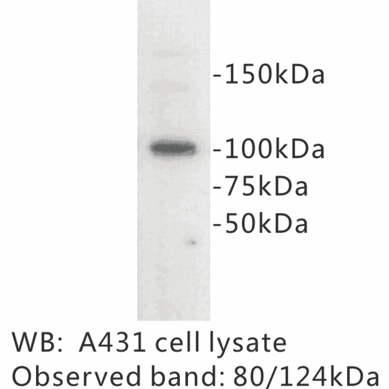 Western Blot - Anti-E Cadherin Antibody (BPA1048) - Antibodies.com