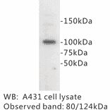 Western Blot - Anti-E Cadherin Antibody (BPA1048) - Antibodies.com