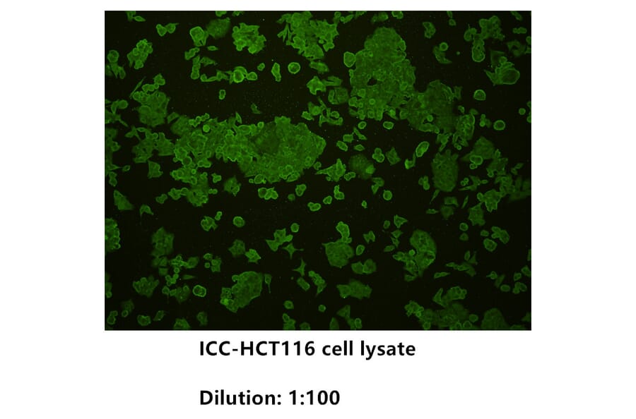 Immunocytochemistry - Anti-E Cadherin Antibody (BPA1048) - Antibodies.com