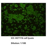 Immunocytochemistry - Anti-E Cadherin Antibody (BPA1048) - Antibodies.com
