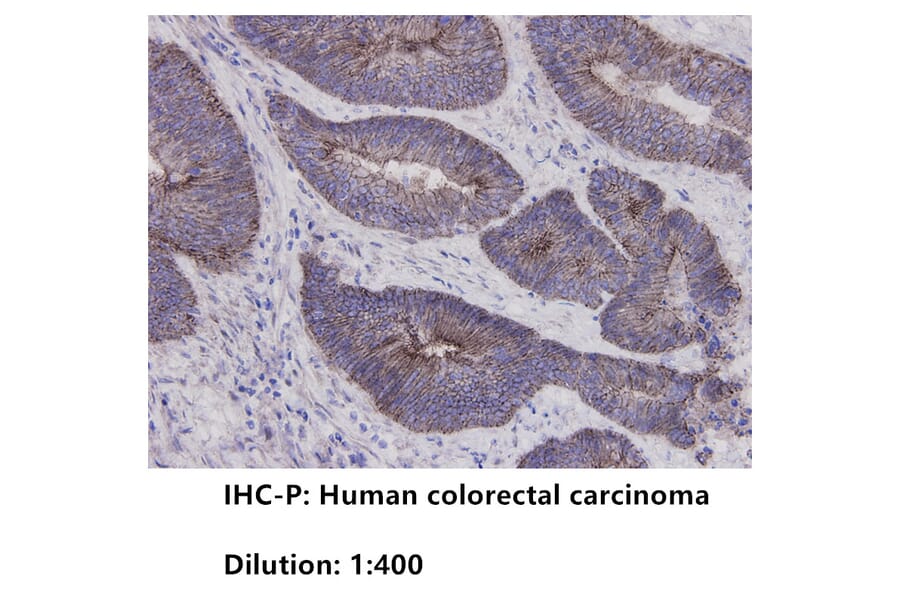 Immunohistochemistry - Anti-E Cadherin Antibody (BPA1048) - Antibodies.com