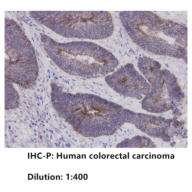 Immunohistochemistry - Anti-E Cadherin Antibody (BPA1048) - Antibodies.com