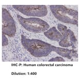 Immunohistochemistry - Anti-E Cadherin Antibody (BPA1048) - Antibodies.com