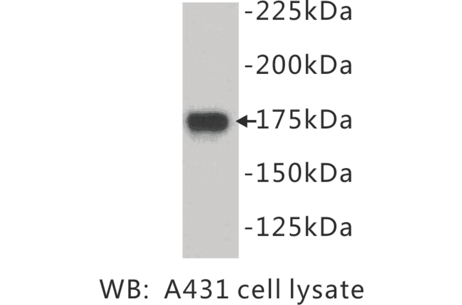 Western Blot - Anti-EGF Receptor Antibody (BPA1049) - Antibodies.com