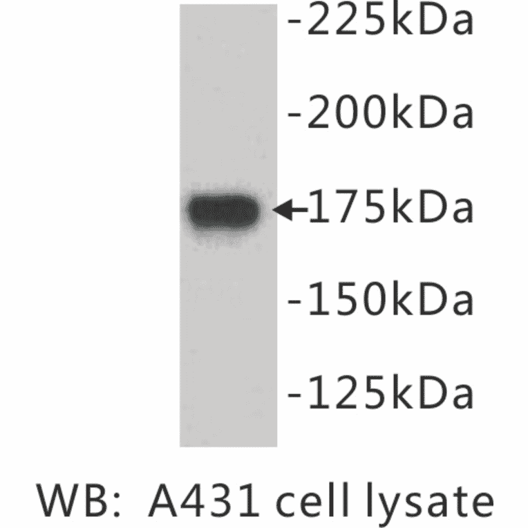 Western Blot - Anti-EGF Receptor Antibody (BPA1049) - Antibodies.com