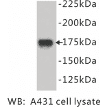 Western Blot - Anti-EGF Receptor Antibody (BPA1049) - Antibodies.com