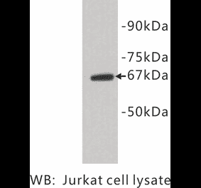 Western Blot - Anti-E Selectin Antibody (BPA1050) - Antibodies.com
