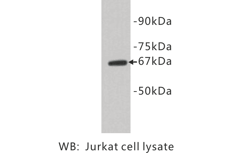 Western Blot - Anti-E Selectin Antibody (BPA1050) - Antibodies.com