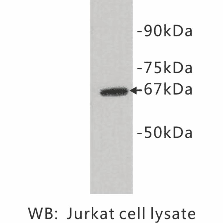 Western Blot - Anti-E Selectin Antibody (BPA1050) - Antibodies.com