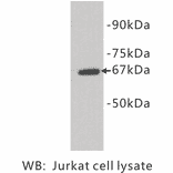 Western Blot - Anti-E Selectin Antibody (BPA1050) - Antibodies.com