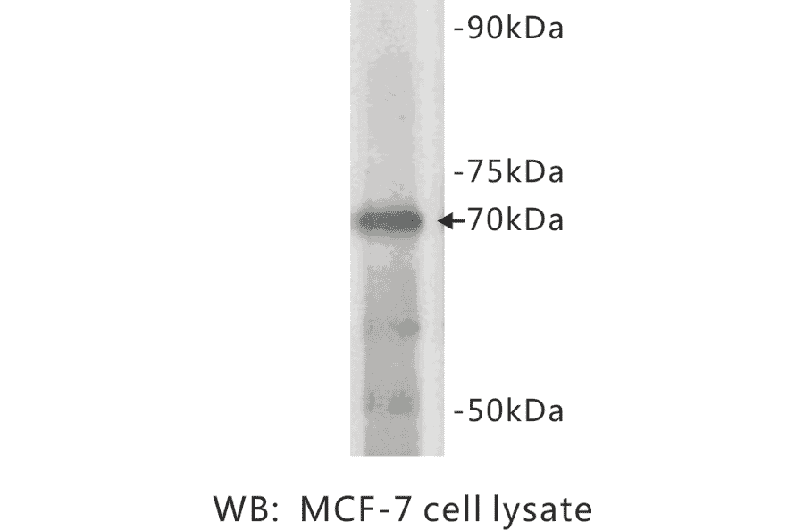 Western Blot - Anti-Estrogen receptor 1 Antibody (BPA1051) - Antibodies.com