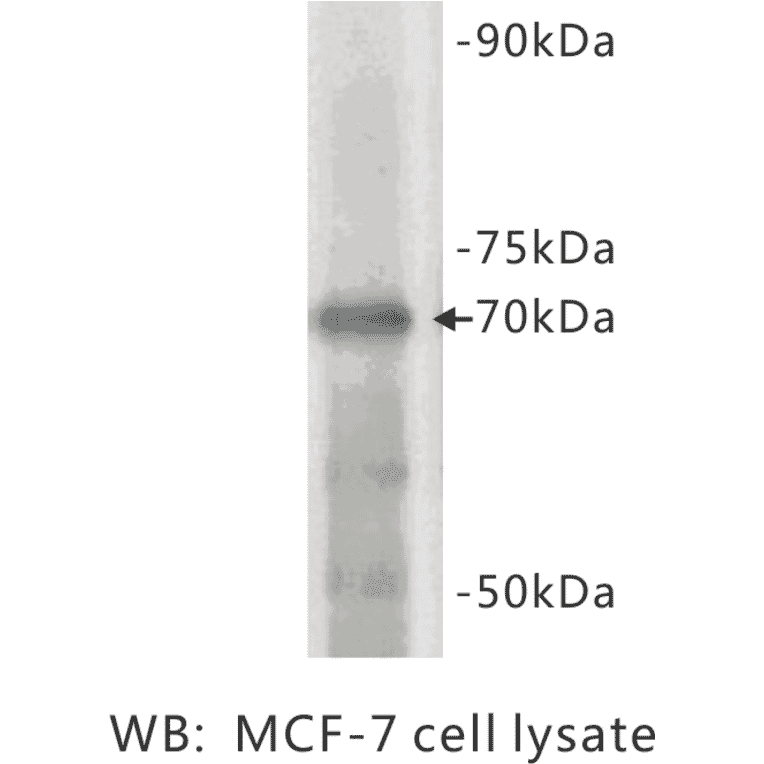 Western Blot - Anti-Estrogen receptor 1 Antibody (BPA1051) - Antibodies.com