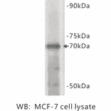 Western Blot - Anti-Estrogen receptor 1 Antibody (BPA1051) - Antibodies.com