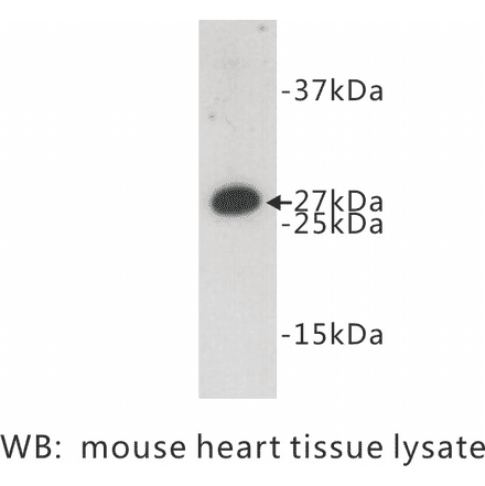 Western Blot - Anti-FADD Antibody (BPA1052) - Antibodies.com