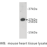 Western Blot - Anti-FADD Antibody (BPA1052) - Antibodies.com