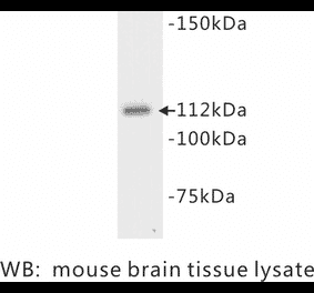 Western Blot - Anti-Flt 3 Antibody (BPA1054) - Antibodies.com