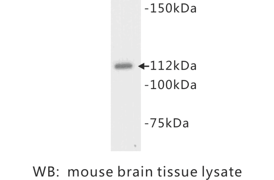 Western Blot - Anti-Flt 3 Antibody (BPA1054) - Antibodies.com