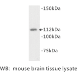 Western Blot - Anti-Flt 3 Antibody (BPA1054) - Antibodies.com