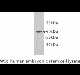 Western Blot - Anti-Frizzled 5 Antibody (BPA1056) - Antibodies.com
