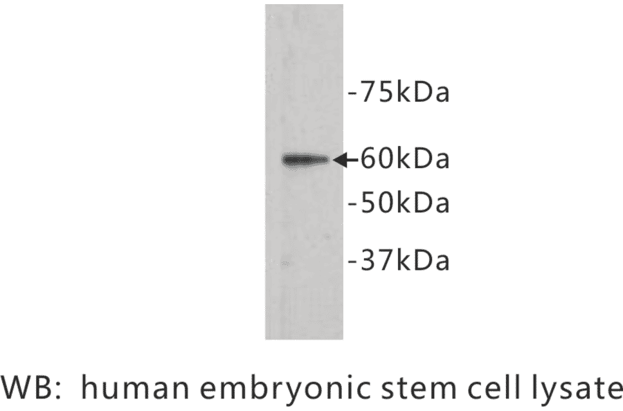 Western Blot - Anti-Frizzled 5 Antibody (BPA1056) - Antibodies.com