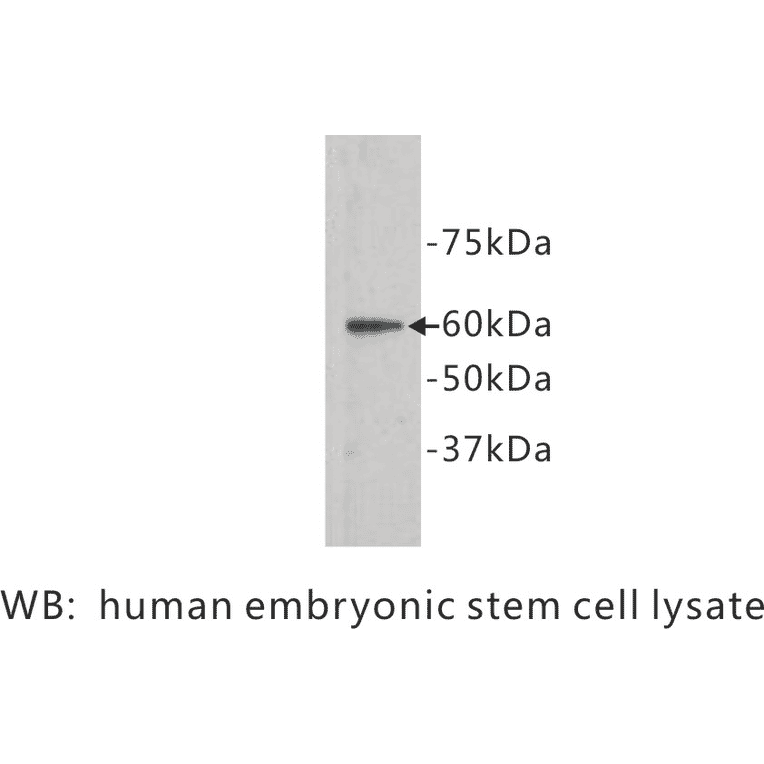 Western Blot - Anti-Frizzled 5 Antibody (BPA1056) - Antibodies.com