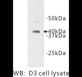 Western Blot - Anti-IL1RL1 Antibody (BPA1063) - Antibodies.com