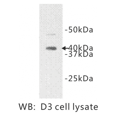Western Blot - Anti-IL1RL1 Antibody (BPA1063) - Antibodies.com