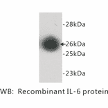 Western Blot - Anti-Interleukin 6 Antibody (BPA1064) - Antibodies.com