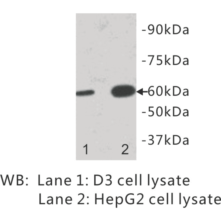 Western Blot - Anti-IL13 receptor alpha 1 Antibody (BPA1066) - Antibodies.com