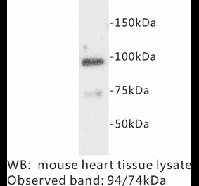 Western Blot - Anti-Junctophilin 2 Antibody (BPA1068) - Antibodies.com