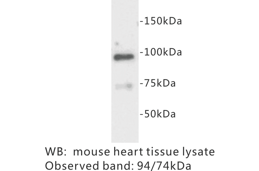 Western Blot - Anti-Junctophilin 2 Antibody (BPA1068) - Antibodies.com