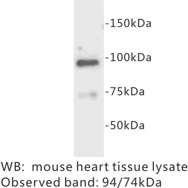 Western Blot - Anti-Junctophilin 2 Antibody (BPA1068) - Antibodies.com