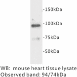 Western Blot - Anti-Junctophilin 2 Antibody (BPA1068) - Antibodies.com