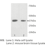 Western Blot - Anti-LDHB Antibody (BPA1070) - Antibodies.com